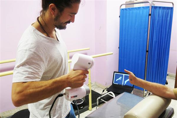 约旦安曼无国界医生中东冲突受害者提供3D打印假肢